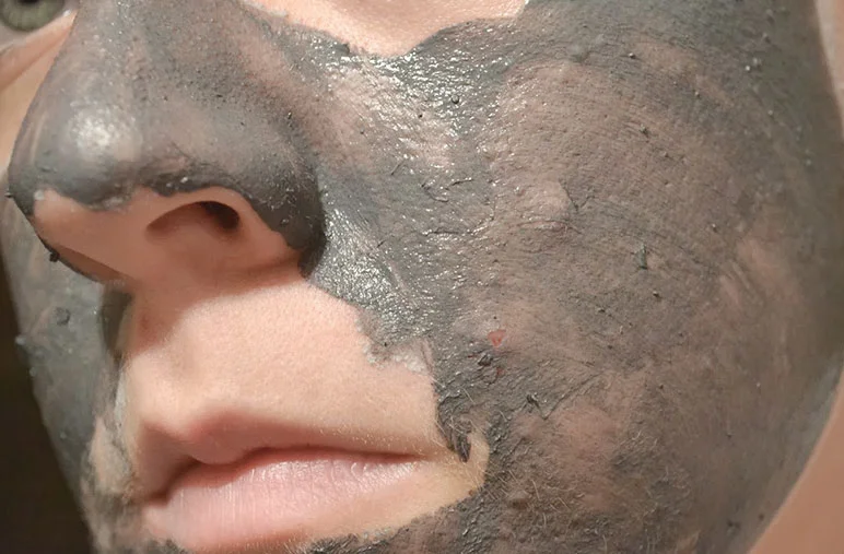 acne clearing treatment