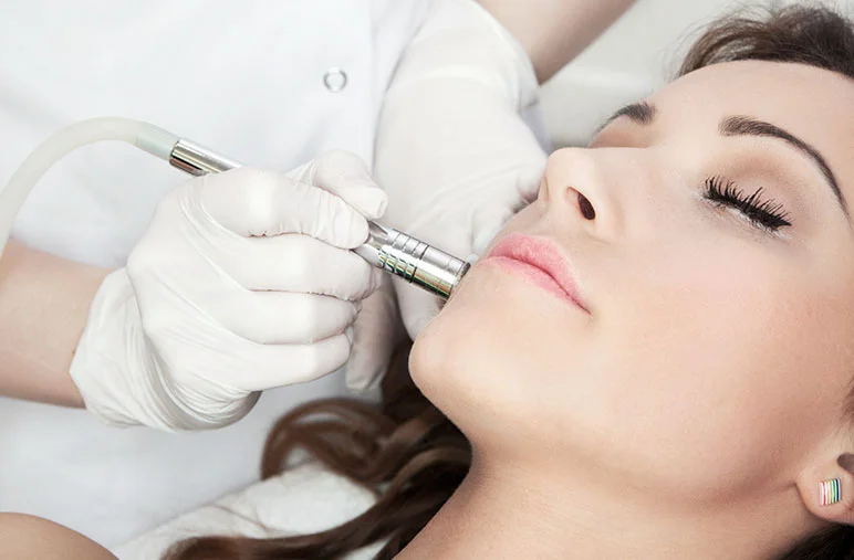 microdermabrasion